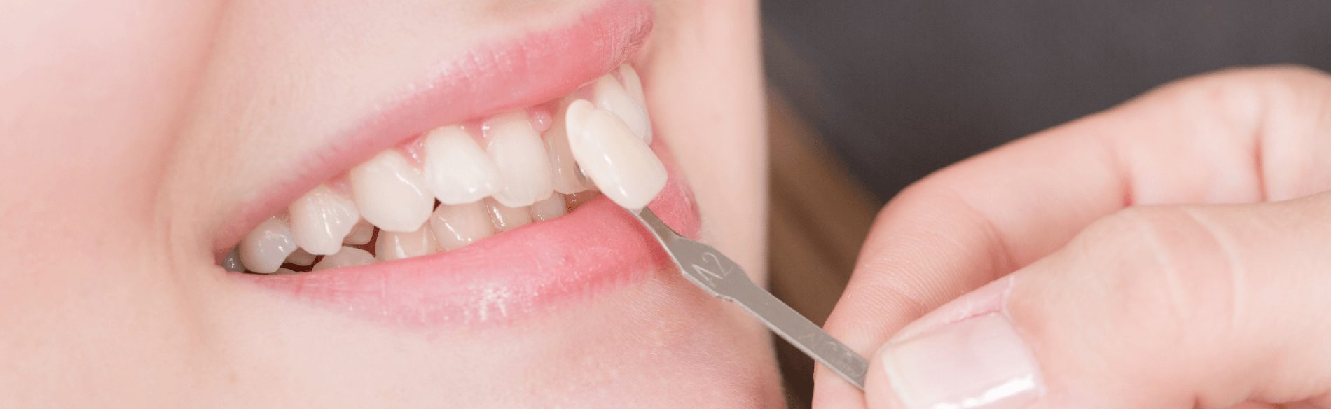 Crown being used to straighten the teeth without braces