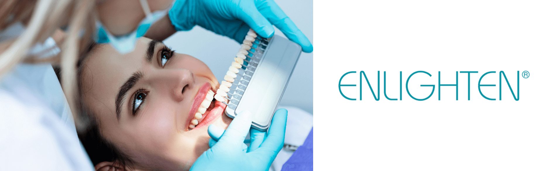 Enlighten whitening at Kiln Lane Dental