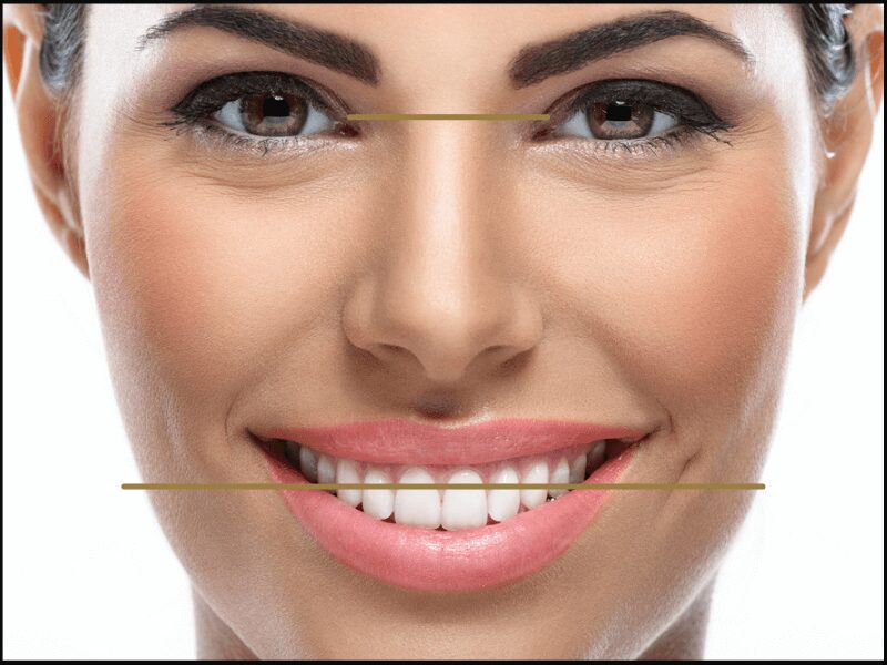 Smile design the modern approach to dentistry Kiln Lane Dental