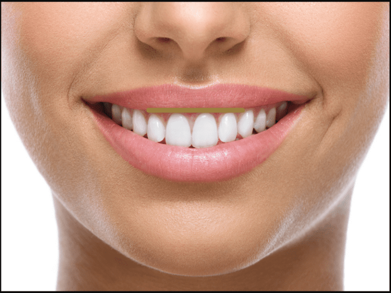 Smile design the modern approach to dentistry Kiln Lane Dental